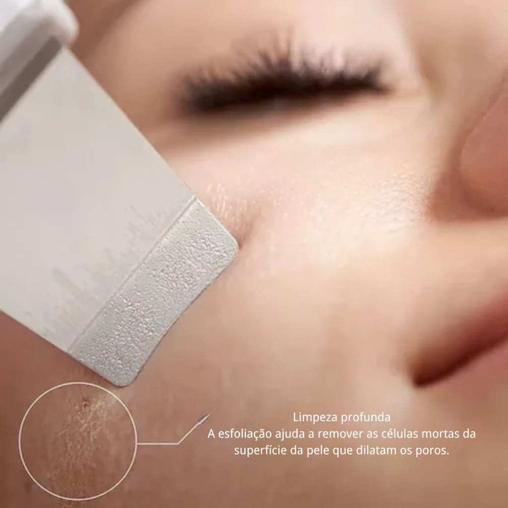 🌟 Peeling Ultrassônico Facial — Limpeza Profunda, Remoção de Cravos e Pele Renovada em Casa! 💆‍♀️